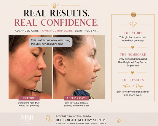 The Unexpected Journey Behind Bee Bright  How One Conversation Changed Everything