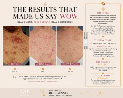 Bee Bright All Day Remedy